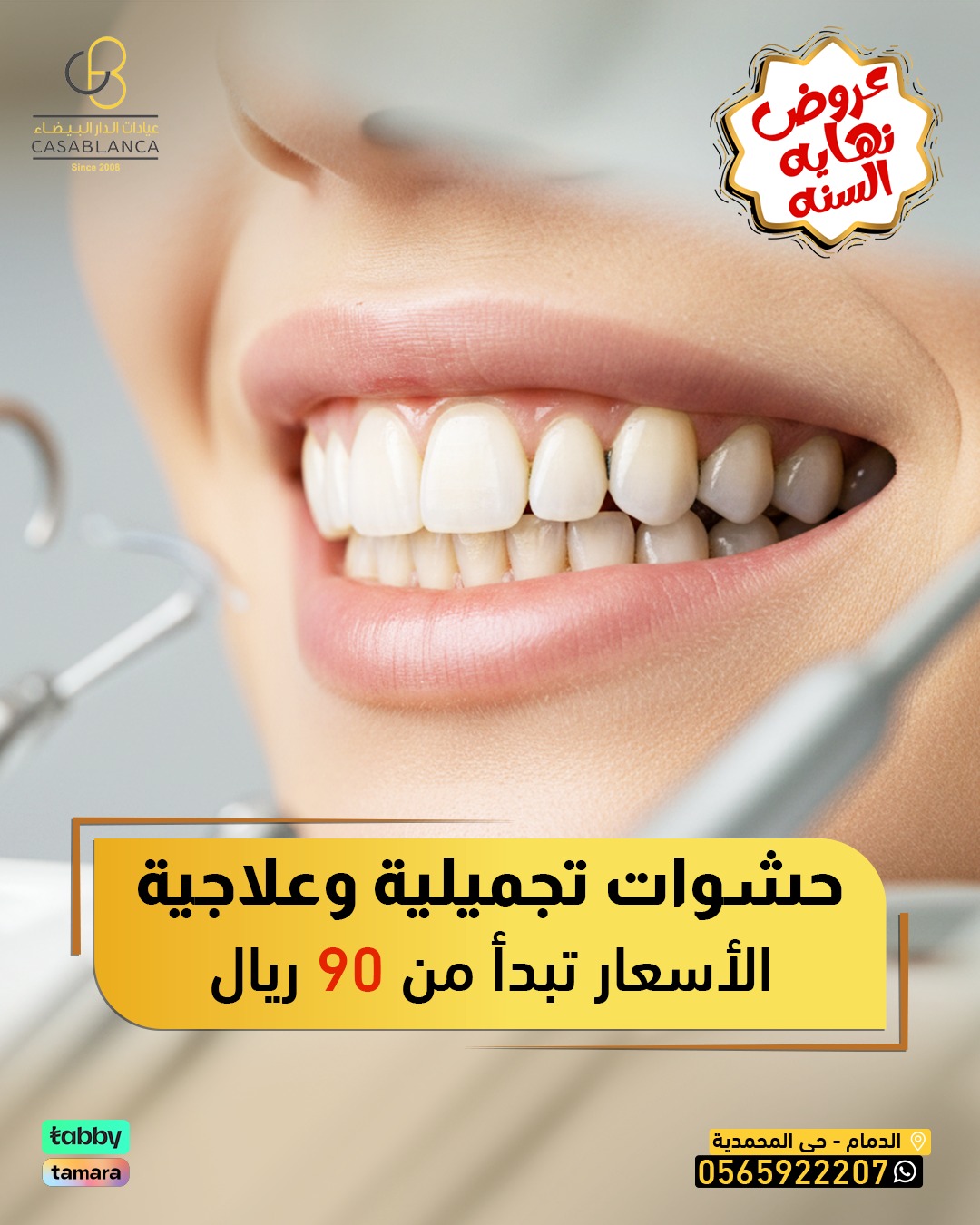 حشوة الأسنان تبدأ من 